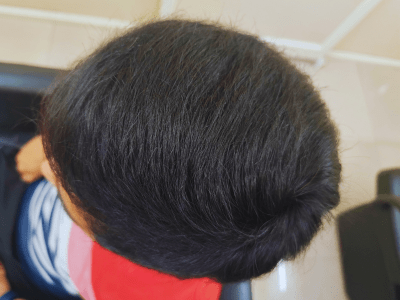 After Hair Clipping