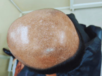 First Step For Hair Bondong