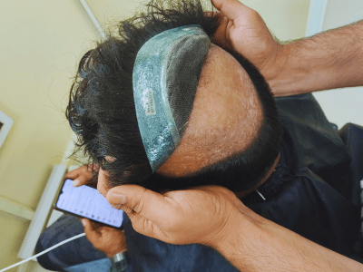 Fixing Wig