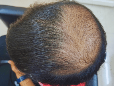 Before Hair Clipping