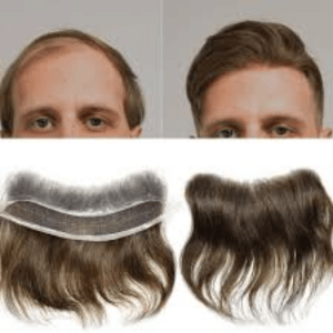 Toppers and Extensions