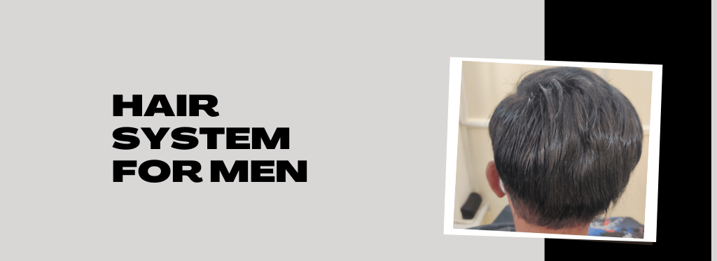 Hair system for men
